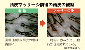 頭皮マッサージの効果